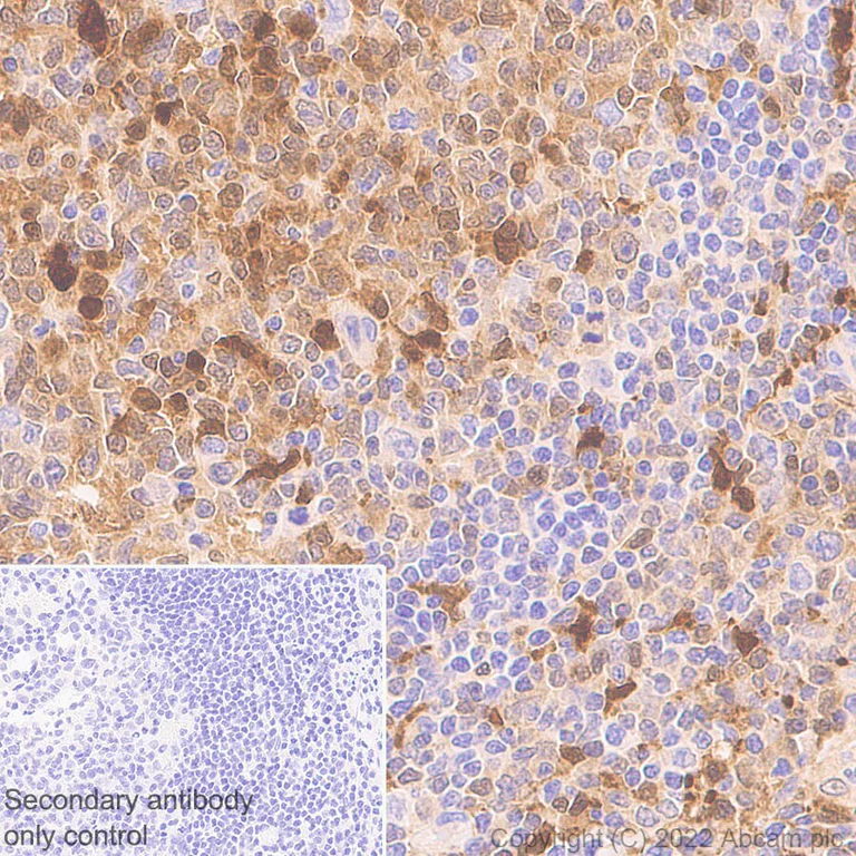 Immunohistochemistry (Formalin/PFA-fixed paraffin-embedded sections) - Anti-ADA antibody [EPR25429-117] (AB300050)