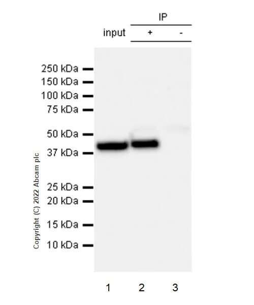 Immunoprecipitation - Anti-ADA antibody [EPR25429-117] (AB300050)