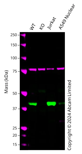 Western blot - Anti-ADA antibody [EPR25429-117] (AB300050)