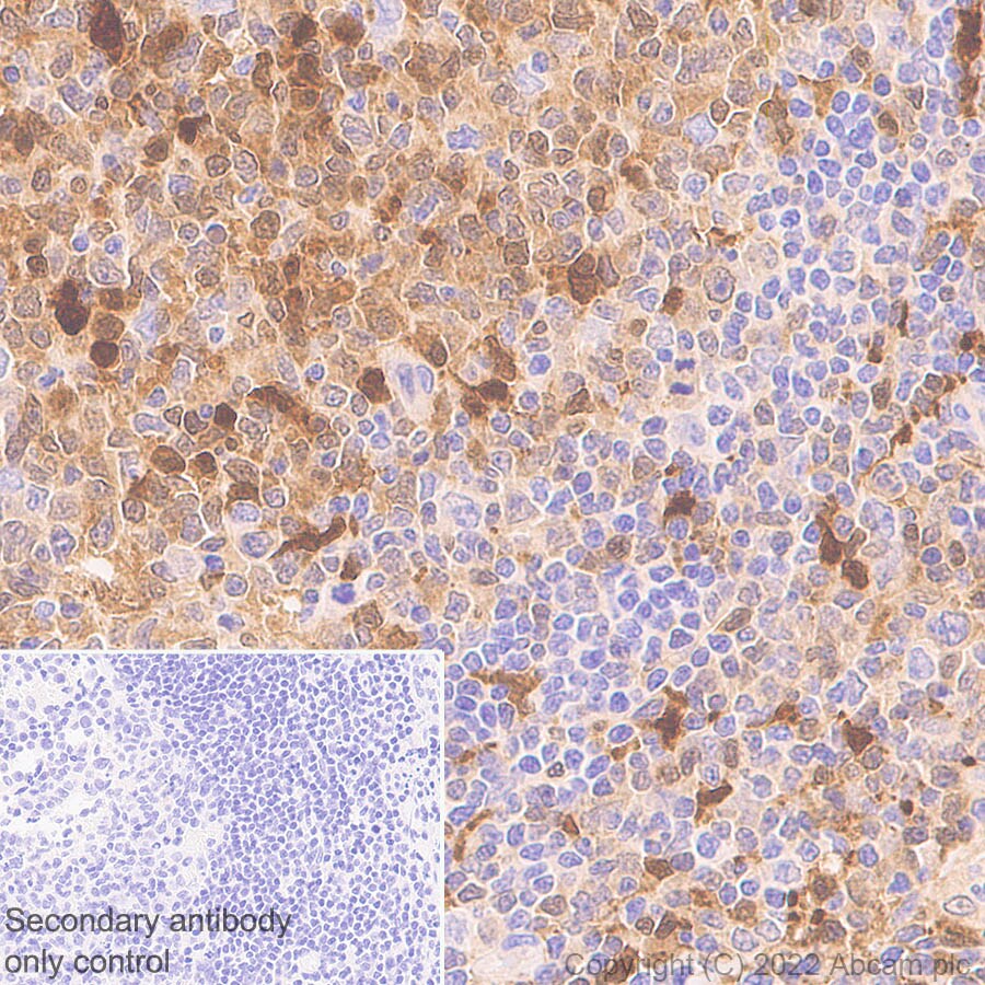 Immunohistochemistry (Formalin/PFA-fixed paraffin-embedded sections) - Anti-ADA antibody [EPR25429-117] (BSA and Azide free) (ab300051), expandable thumbnail