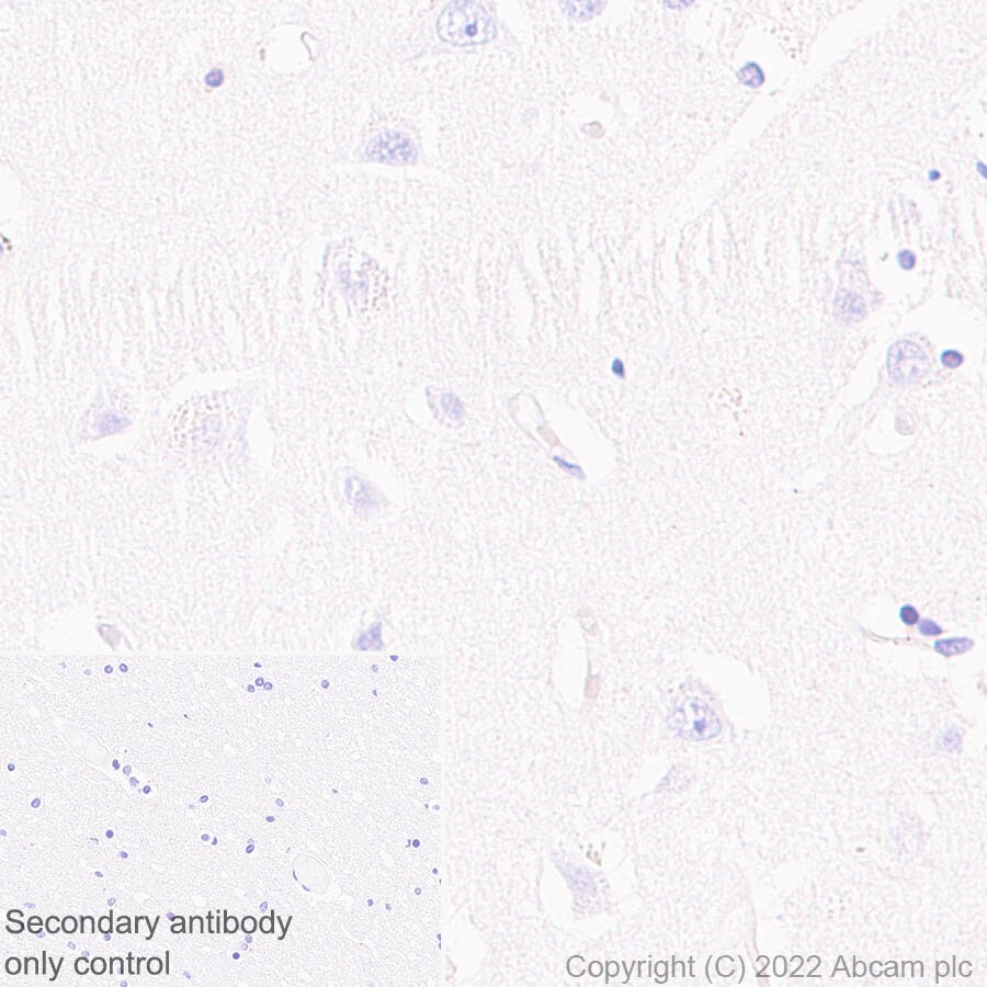 Immunohistochemistry (Formalin/PFA-fixed paraffin-embedded sections) - Anti-ADA antibody [EPR25429-117] (BSA and Azide free) (ab300051), expandable thumbnail