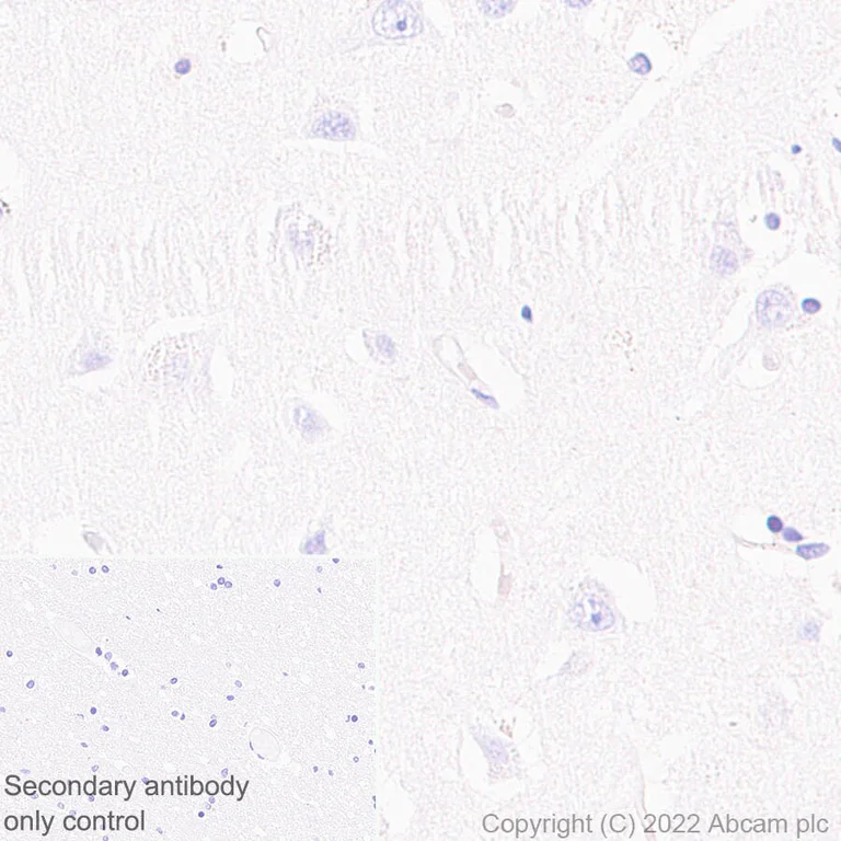 Immunohistochemistry (Formalin/PFA-fixed paraffin-embedded sections) - Anti-ADA antibody [EPR25429-117] (BSA and Azide free) (AB300051)