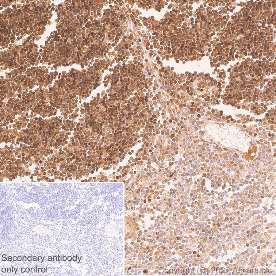 Immunohistochemistry (Formalin/PFA-fixed paraffin-embedded sections) - Anti-ADA antibody [EPR25429-117] (BSA and Azide free) (AB300051), expandable thumbnail