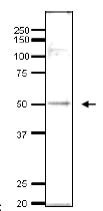 Western blot - Anti-ADA2 antibody (AB215524)