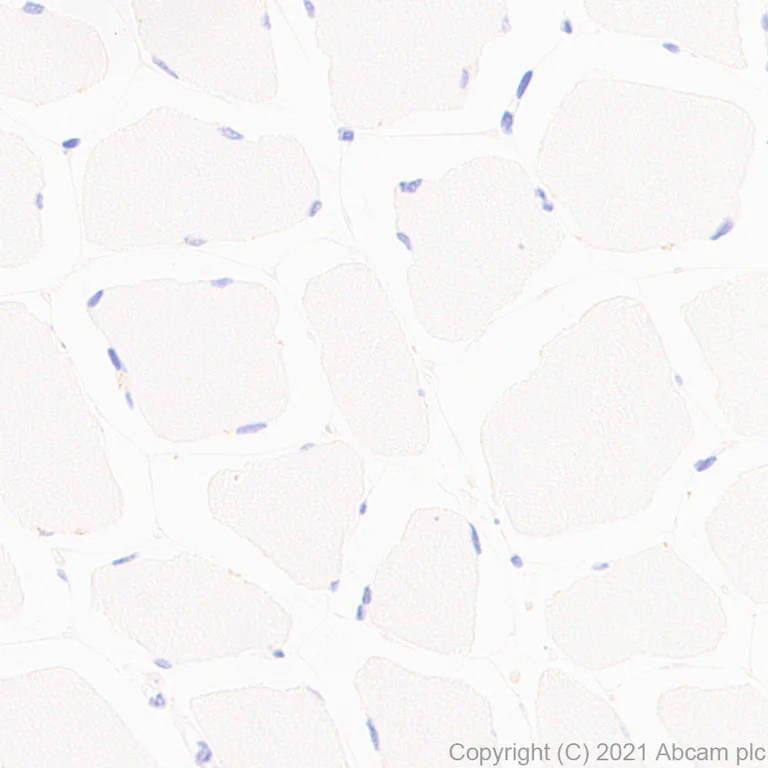 Immunohistochemistry (Formalin/PFA-fixed paraffin-embedded sections) - Anti-ADA2 antibody [EPR25430-131] (AB288296)