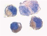 Anti-ADAM10 antibody
