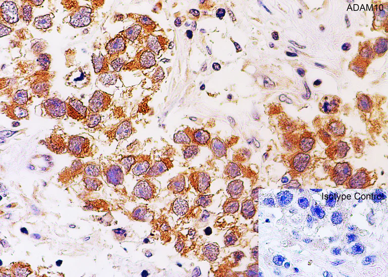 Immunohistochemistry (Formalin/PFA-fixed paraffin-embedded sections) - Anti-ADAM10 antibody (AB1997)