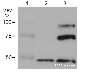 Western blot - Anti-ADAM10 antibody (AB1997)