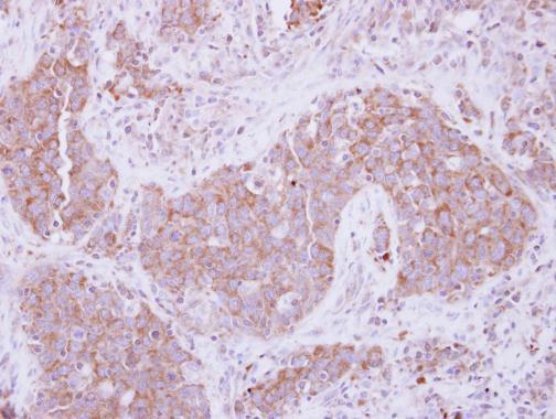 Immunohistochemistry (Formalin/PFA-fixed paraffin-embedded sections) - Anti-ADAM10 antibody (AB227172)