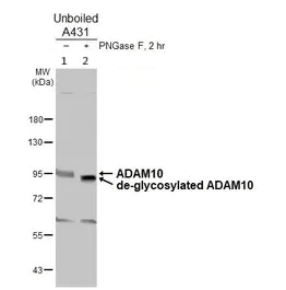 Western blot - Anti-ADAM10 antibody (AB227172)