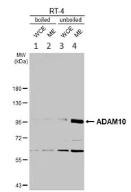 Western blot - Anti-ADAM10 antibody (AB227172)