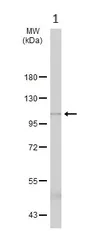 Western blot - Anti-ADAM10 antibody (AB227172)