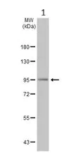 Western blot - Anti-ADAM10 antibody (AB227172)