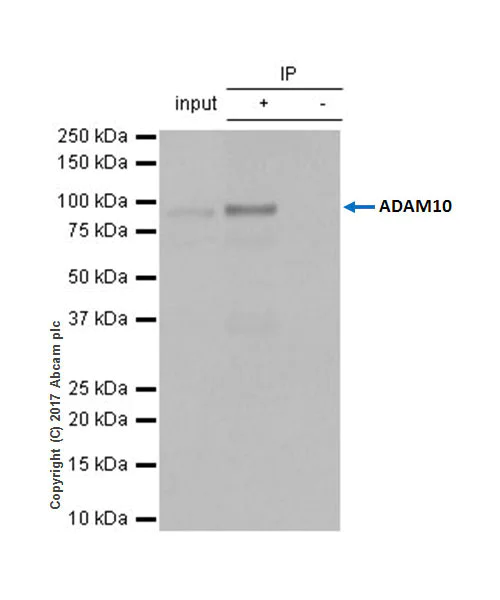 Immunoprecipitation - Anti-ADAM10 antibody [EPR5622] (AB124695)