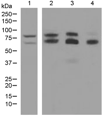 Western blot - Anti-ADAM10 antibody [EPR5622] (AB124695)