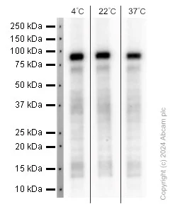 Western blot - Anti-ADAM10 antibody [EPR5622] (AB124695)