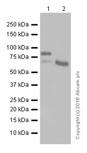 Western blot - Anti-ADAM10 antibody [EPR5622] (AB124695)