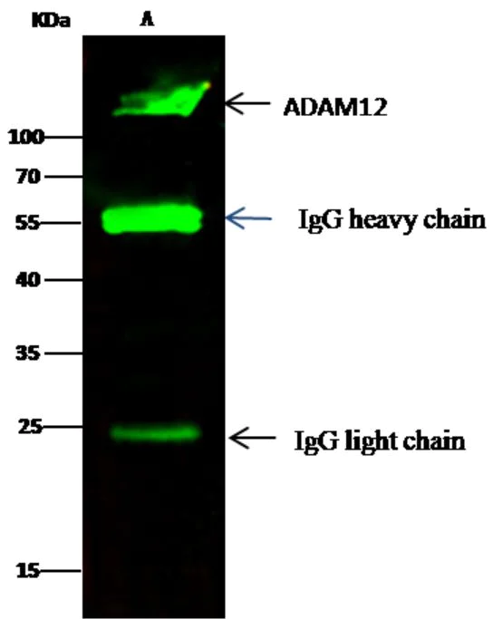 Immunoprecipitation - Anti-ADAM12 antibody [737] - BSA and Azide free (AB276047)