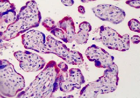 Immunohistochemistry (Formalin/PFA-fixed paraffin-embedded sections) - Anti-ADAM12 antibody (AB115203)