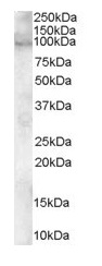 Western blot - Anti-ADAM12 antibody (AB115203), expandable thumbnail