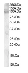 Western blot - Anti-ADAM12 antibody (AB115203)
