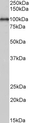 Western blot - Anti-ADAM12 antibody (AB223476), expandable thumbnail
