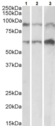 Western blot - Anti-ADAM12 antibody (AB223476)