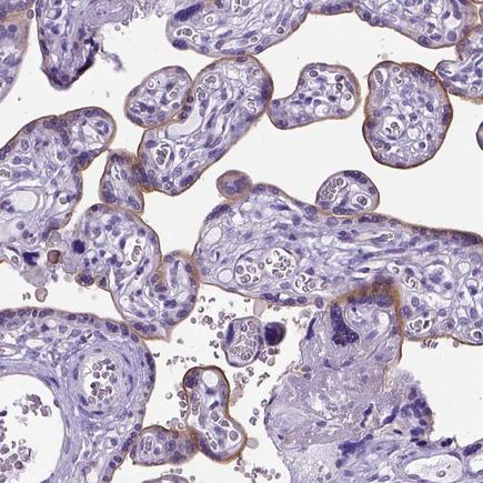 Immunohistochemistry (Formalin/PFA-fixed paraffin-embedded sections) - Anti-ADAM12 antibody (AB223745)