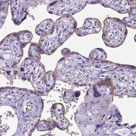 Immunohistochemistry (Formalin/PFA-fixed paraffin-embedded sections) - Anti-ADAM12 antibody (AB223745)