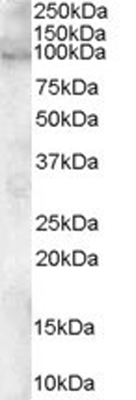 Western blot - Anti-ADAM12 antibody (AB28747)