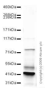 Western blot - Anti-ADAM12 antibody - Aminoterminal end (AB39155), expandable thumbnail