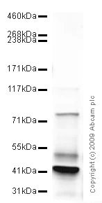 Western blot - Anti-ADAM12 antibody - Aminoterminal end (AB39155)