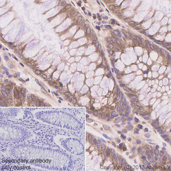 Immunohistochemistry (Formalin/PFA-fixed paraffin-embedded sections) - Anti-ADAM15 antibody [EPR5619] (AB124698)