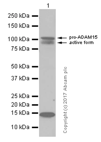 Western blot - Anti-ADAM15 antibody [EPR5619] (AB124698)