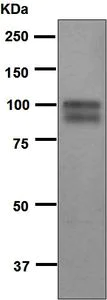 Western blot - Anti-ADAM15 antibody [EPR5619] (AB124698)