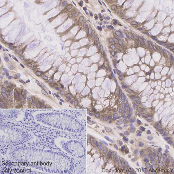 Immunohistochemistry (Formalin/PFA-fixed paraffin-embedded sections) - Anti-ADAM15 antibody [EPR5619] - BSA and Azide free (AB232389), expandable thumbnail