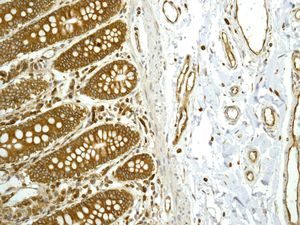 Immunohistochemistry (Formalin/PFA-fixed paraffin-embedded sections) - Anti-ADAM15 antibody [EPR5619] - BSA and Azide free (AB232389), expandable thumbnail