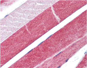 Immunohistochemistry (Formalin/PFA-fixed paraffin-embedded sections) - Anti-ADAM15 antibody - N-terminal (AB137387)