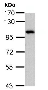 Western blot - Anti-ADAM15 antibody - N-terminal (AB137387), expandable thumbnail