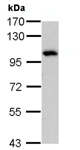 Western blot - Anti-ADAM15 antibody - N-terminal (AB137387)