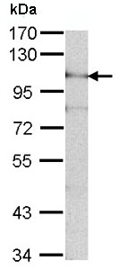 Western blot - Anti-ADAM15 antibody - N-terminal (AB137387), expandable thumbnail