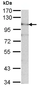 Western blot - Anti-ADAM15 antibody - N-terminal (AB137387)