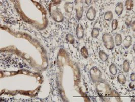 Immunohistochemistry (Formalin/PFA-fixed paraffin-embedded sections) - Anti-ADAM17 antibody [1F6] (AB57484)