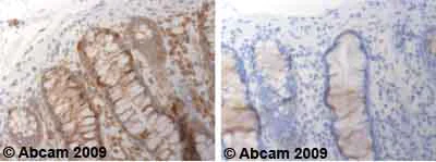 Immunohistochemistry (Formalin/PFA-fixed paraffin-embedded sections) - Anti-ADAM17 antibody (AB39162)