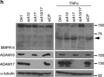Western blot - Anti-ADAM17 antibody (AB39162)