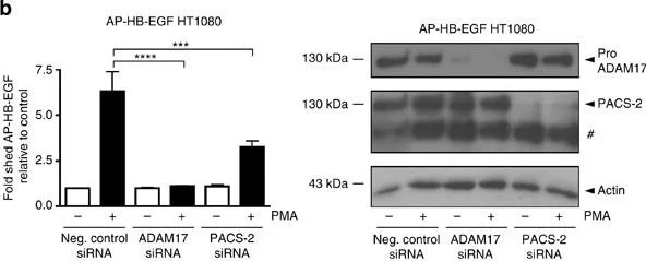 Western blot - Anti-ADAM17 antibody (AB39162)