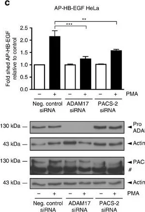 Western blot - Anti-ADAM17 antibody (AB39162)