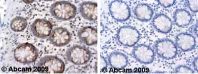 Immunohistochemistry (Formalin/PFA-fixed paraffin-embedded sections) - Anti-ADAM17 antibody (AB39163)