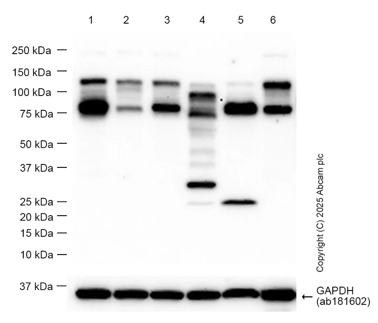 Western blot - Anti-ADAM17 antibody [EPR21129-131] - BSA and Azide free (AB291100)