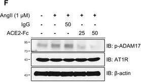 Western blot - Anti-ADAM17 (phospho T735) antibody (AB182630)